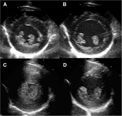 Heart Rate and Heart Rate Variability of Rhesus Macaques (Macaca mulatta) Affected by Left Ventricular Hypertrophy